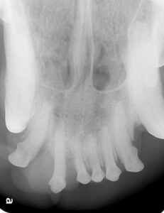 vet dentistry radiograph before oral tumor operation
