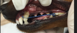 An active force appliance to correct a malocclusion