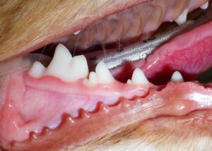 healthy gums