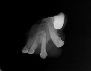 radiograph